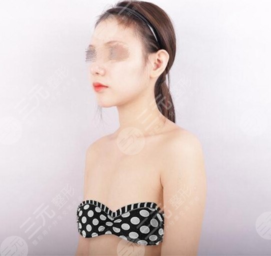 上海九院整外三巨头是哪三位？面对这么多优质医生，求美者难免挑花了眼
