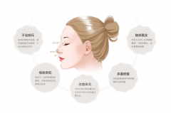自体软骨隆鼻术后恢复需要多久?有后遗症吗?价位多少
