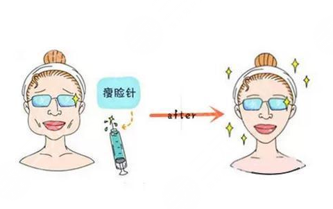 注射瘦脸注射