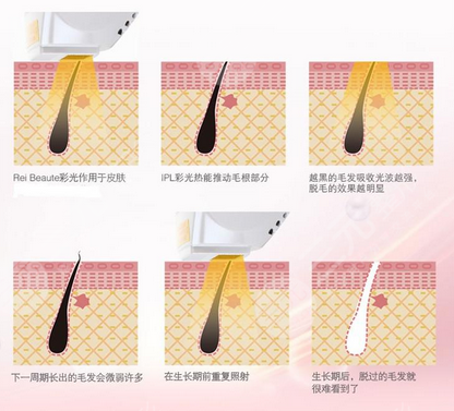 彩光长时间脱毛原理