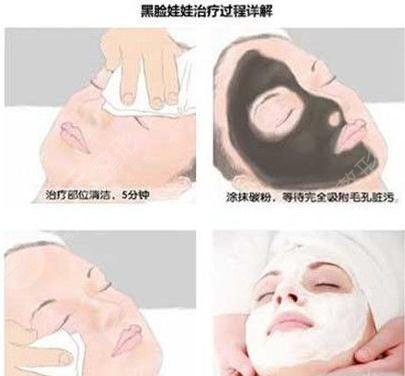 黑脸娃娃手术后注意事项