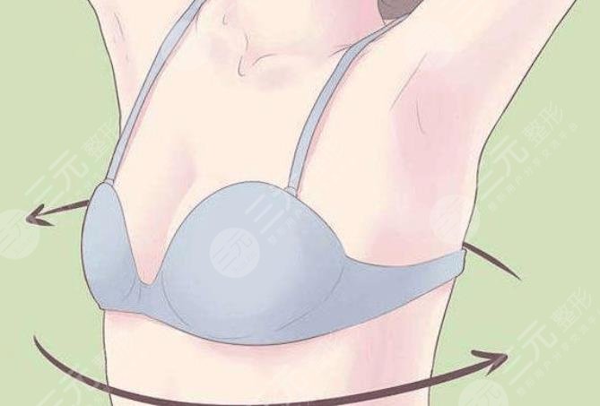 曼托假体隆胸+自体脂肪隆胸真人案例恢复过程照片