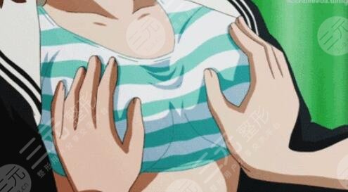 重庆自体脂肪隆胸，1个半月后的果