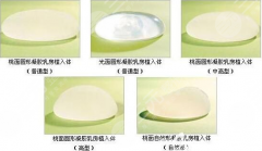 上海妙桃假体丰胸多少钱？当然所有人在意的就是做完假体之后轮廓是否自然