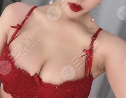 上海妙桃假体丰胸多少钱？当然所有人较在意的就是做完假体之后轮廓是否自然