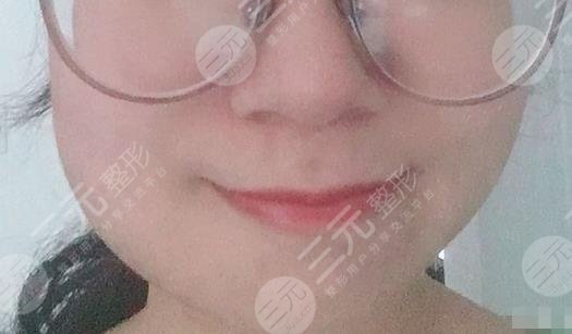 深圳南州口腔拔牙经历分享