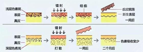 白瓷娃娃的原理