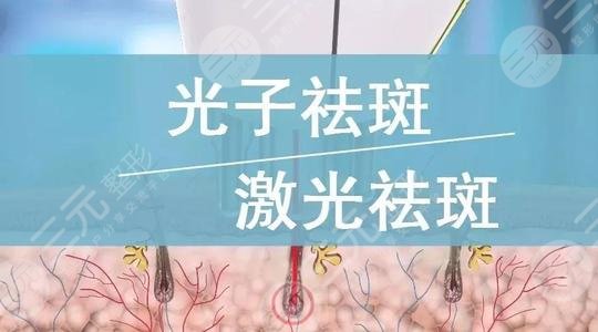 激光美容祛斑手术