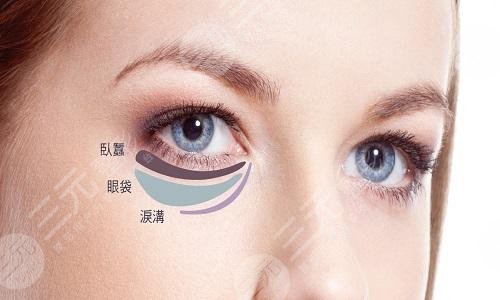 怎样去除黑眼袋