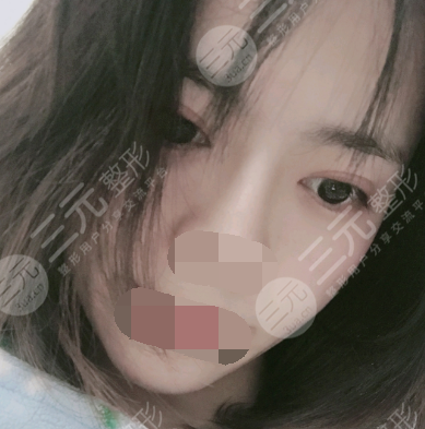 上海久雅整形医院正规吗