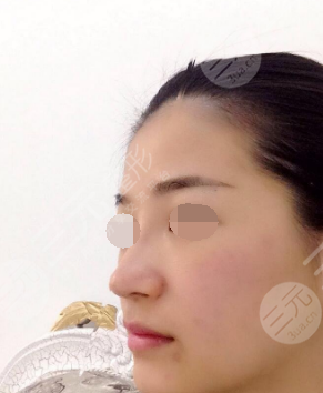 广州妍希整形美容医院口碑怎么样?揭秘医院地址 新价格表!