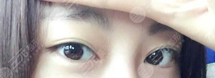 上海zy国际整形怎么样好吗
