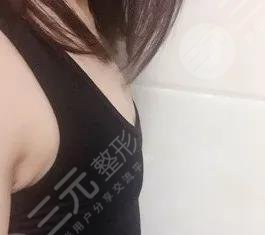 西安西京医院整形美容科价目表及用户整形经历分享