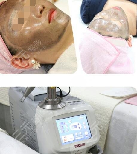 黑脸娃娃原理是什么