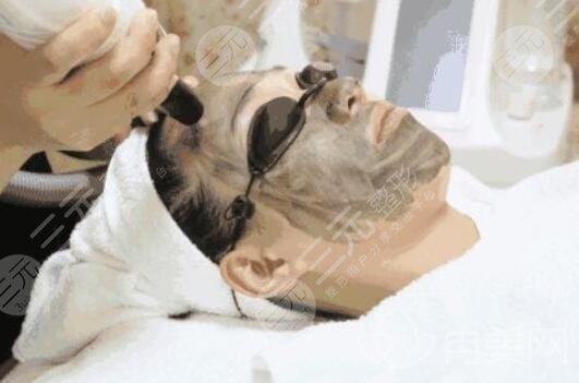 黑脸娃娃可以祛痘吗？成好吗？黑脸娃娃的优势是什么？