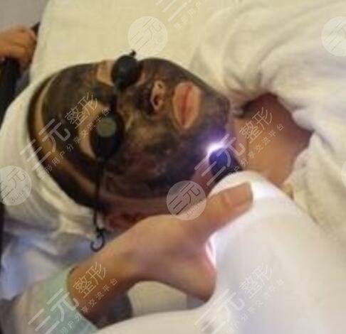 什么是黑脸娃娃