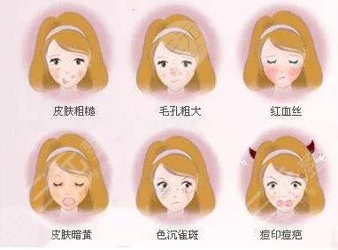 光子嫩肤适合哪些人群进行操作?