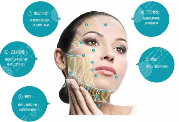 激光除皱多少钱啊？激光除皱原理及适应人群须知！