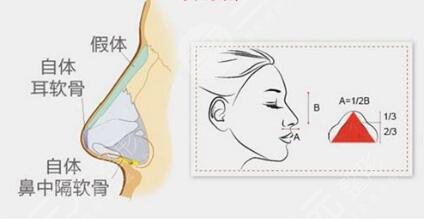 与手术的方法有关