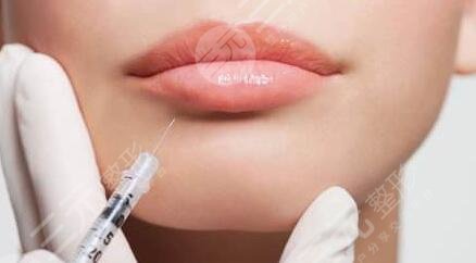 玻尿酸丰唇的果怎么样？小姐姐告诉你玻尿酸丰唇的优势