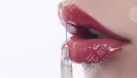 玻尿酸酸注射丰唇手术前注意事项