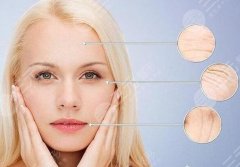 去掉眼角鱼尾纹的价格是多少钱？真实术后果参考一下~