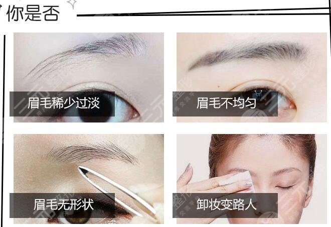 北京绣眉价格大概多少钱？要当漂亮美眉，先get这篇攻略！