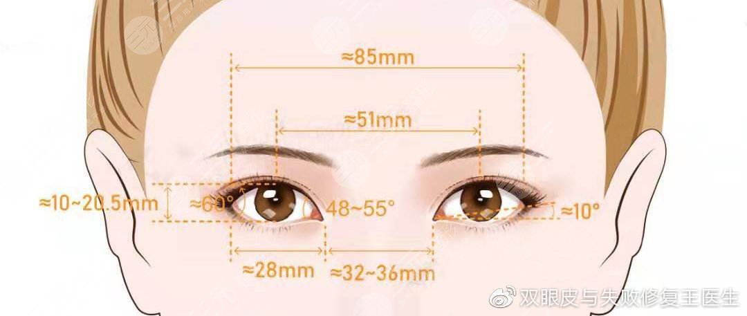 外眼角开大手术