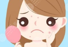 芦荟胶能祛痘和痘印吗？科普揭秘，别再相信护肤“传奇”！