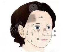 颧骨长痘什么原因引起？揭秘痘痘的搞定方法！