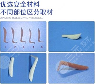假体隆鼻