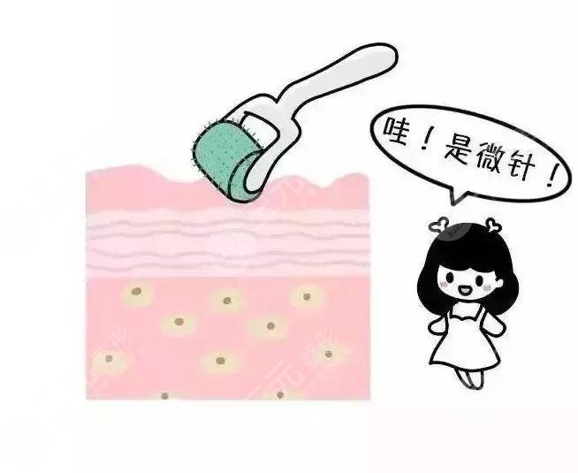 微针可以用来去痘坑吗