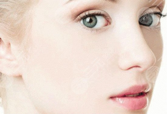 痤疮瘢痕的缓解方法有哪些