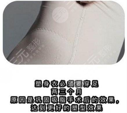 术后注意事项