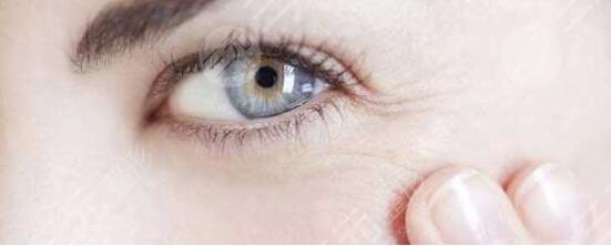 去掉眼角鱼尾纹的价格是多少钱？真实术后果参考一下~