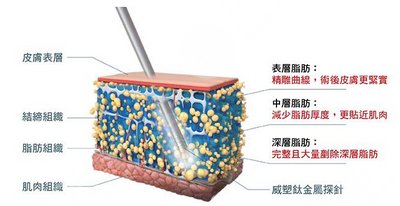 威塑吸脂和黄金微雕的区别科普！肉圆子们适合哪种？快来pick自己的！