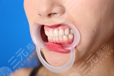 淄博可恩口腔医院价目表