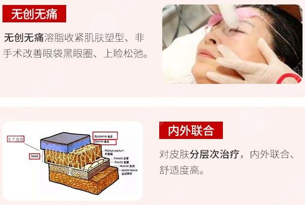欧洲之星