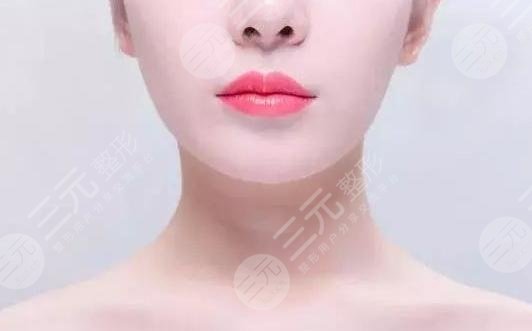 玻尿酸丰唇手术成好吗