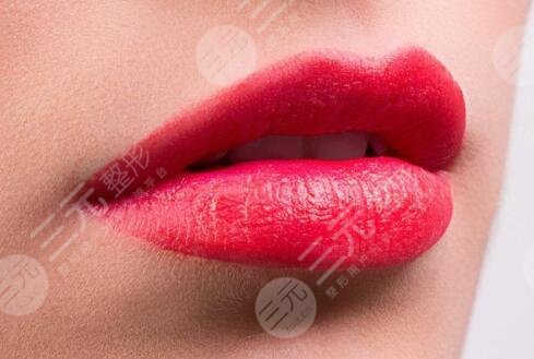 胶原蛋白丰唇6大注意事项