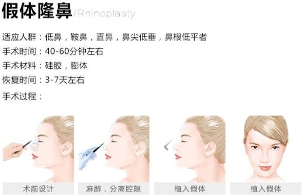 假体隆鼻有副作用吗？3大注意事项科普，教你避免不良反应！