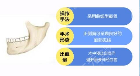 面部神经受损