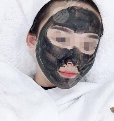 黑脸娃娃效果图公开!收敛你的肌肤问题,细嫩不是梦!