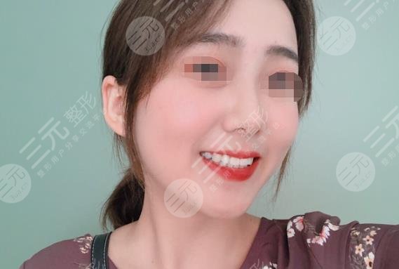 武汉德亚口腔牙齿矫正分享