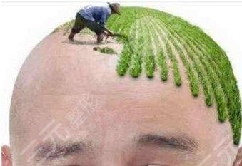 种头发价格多少钱,靠谱吗?掉发狂魔们看过来,get你的攻略! 种头发价格多少钱,靠谱吗?掉发狂魔们看过来,get你的攻略!