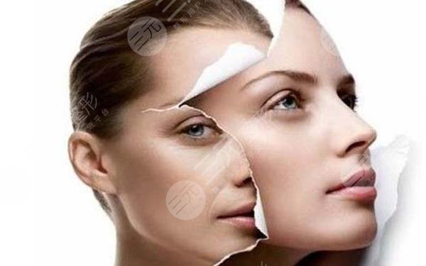 祛痘除疤手术多少钱