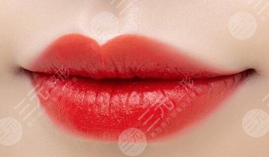 玻尿酸丰唇术成好吗？5大注意事项|玻尿酸丰唇术后案例果