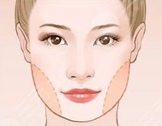 面部吸脂会反弹吗？肉脸的整形攻略来咯！科普为你解惑~