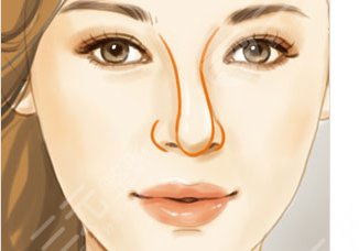 歪鼻矫正术**高吗?科普&注意事项分享,美鼻秘籍要收藏! 歪鼻矫正术**高吗?科普&注意事项分享,美鼻秘籍要收藏!