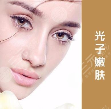 光子嫩肤的价格是怎么收费的